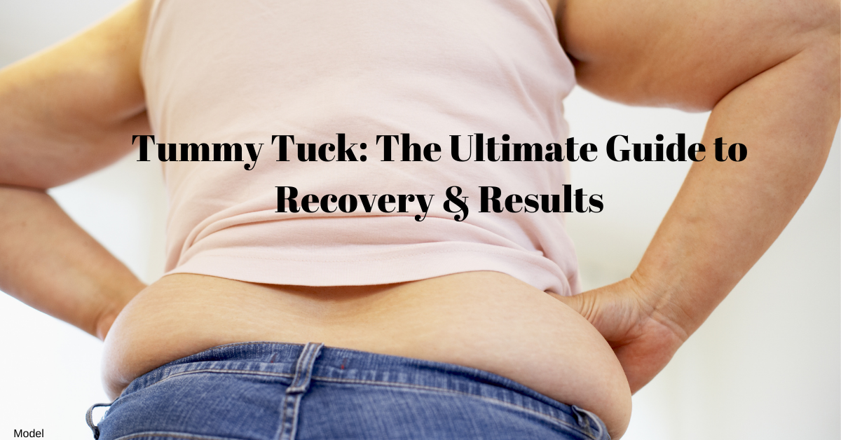 Recovery From A Tummy Tuck: What Should You Expect?